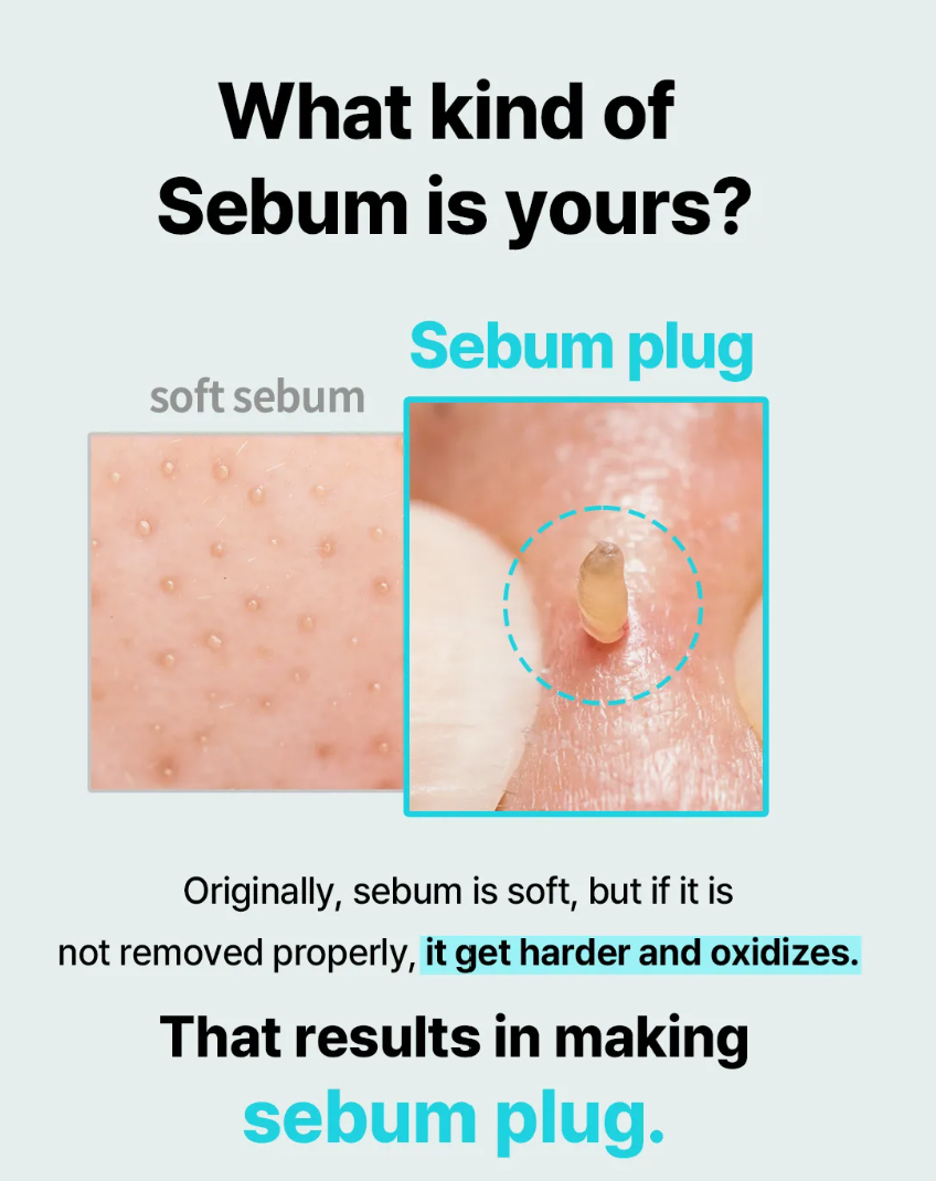 ilso Super Melting Sebum Softener 150ml – Gentle Sebum Control, Deep Cleansing, & Soothing Care for Oily Skin | Exfoliates, Prevents Clogged Pores, & Balances Oil Levels with Squalane, Fruit Complex & Centella Asiatica for Clear, Smooth Skin