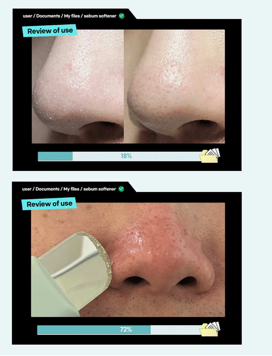 ilso Super Melting Sebum Softener 150ml – Gentle Sebum Control, Deep Cleansing, & Soothing Care for Oily Skin | Exfoliates, Prevents Clogged Pores, & Balances Oil Levels with Squalane, Fruit Complex & Centella Asiatica for Clear, Smooth Skin